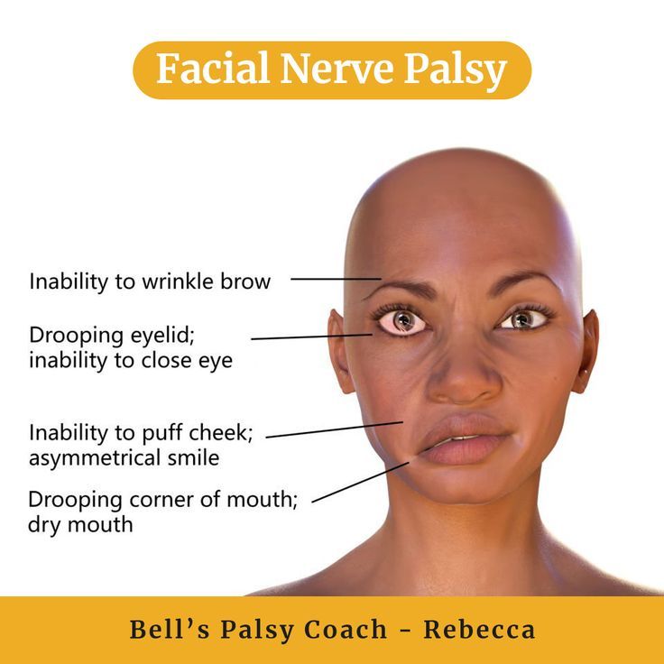 空调房成面瘫高发地？新加坡贡方堂TCM中医馆“扶正祛邪“治面瘫有良方
