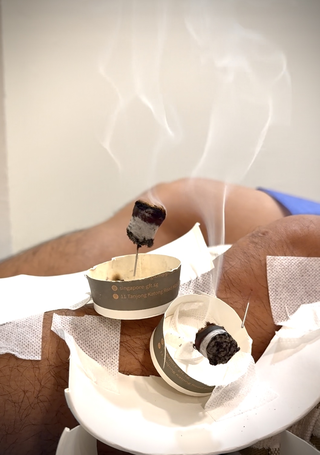 新加坡疼痛治疗中医诊所推荐 ，贡方堂TCM亲测靠谱，口碑响当当~