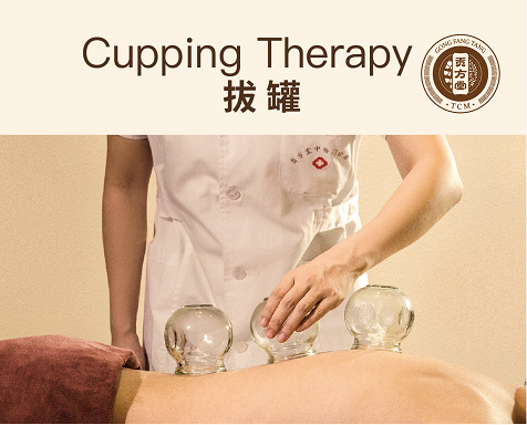 拔罐新加坡哪家好？要多少钱？贡方堂TCM专业又实惠，不完套路！