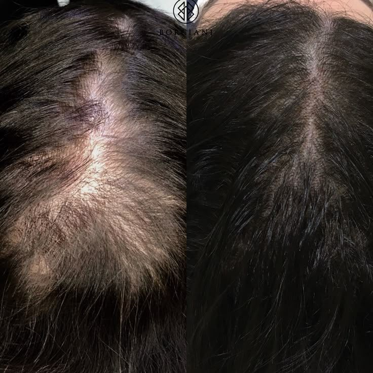 新加坡中医看脱发掉发哪家强？贡方堂TCM陈慧芳一人一方对症调YYDS